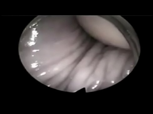 cover video Video Internal  Vagina 