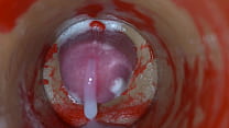 Insemination - Internal Camera Captures Deep Ma...