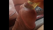 Put a bead chain into the urethra
