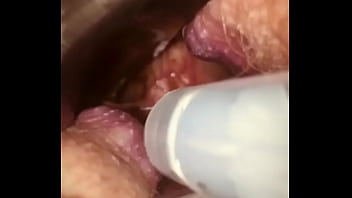Rectal wall injection - XVIDEOS.COM