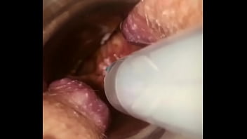 Rectal wall injection - XVIDEOS.COM