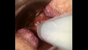 Rectal wall injection - XVIDEOS.COM
