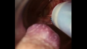 Rectal wall injection - XVIDEOS.COM