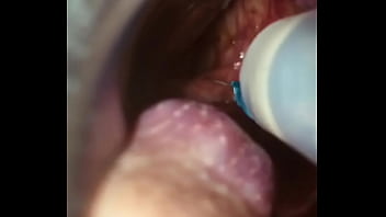 Rectal wall injection - XVIDEOS.COM