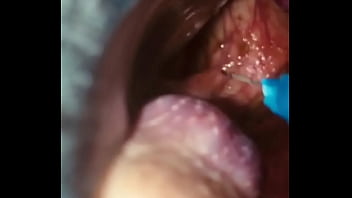 Rectal wall injection - XVIDEOS.COM