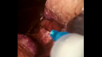 Rectal wall injection - XVIDEOS.COM