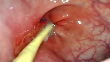 POV ANAL EXTREMO. CÂMERA DENTRO DO CU DELA ENQUANTO EU A BATE COM MEU PAU GRANDE E GOZO BEM DENTRO