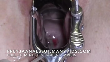 Amateur Freyjaanalslut : Second Insemination attempt. Opening Freyja's cunt and exposing Freyja's cervix - pushing my cum through Freyja's Cervix - Full version on ManyVids