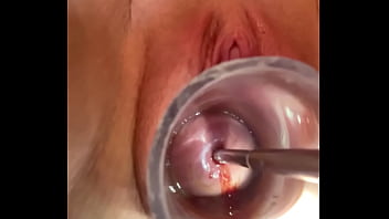 Wet Fucking Squishy Noises As 7mm Sound Goes Deep In Cervix...