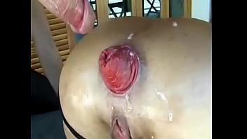 Porn - Arre Milf Hardcore Anal Fisting Prolapse