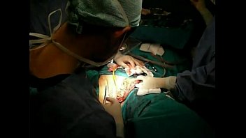 Chirurgie De Changement De Sexe (Chirurgie D'échange Sexuel)