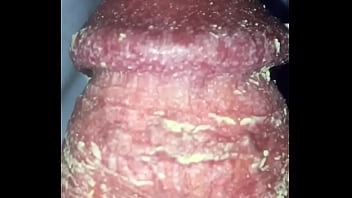 Pénis Rempli De Smegma