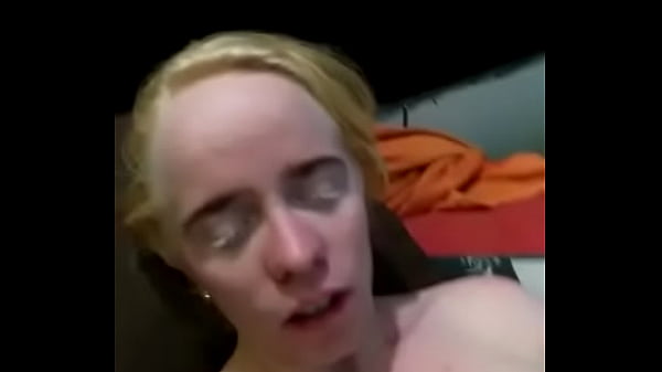 Naked Albino Men Naked Albino Men