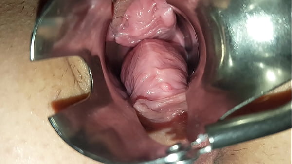 Devon Angela Bonson Gape Thumbnail