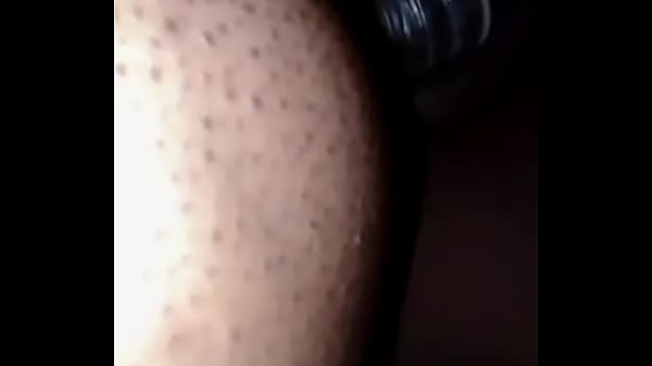 Condom climp Thumbnail