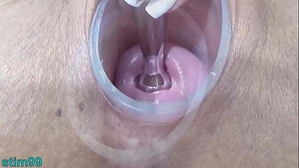 Japanese Wife Open Cervix Wide to watch inside Uterus
