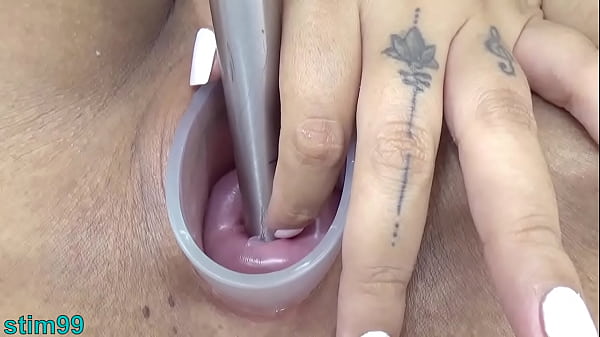 Japanese Wife Open Cervix Wide to watch inside Uterus