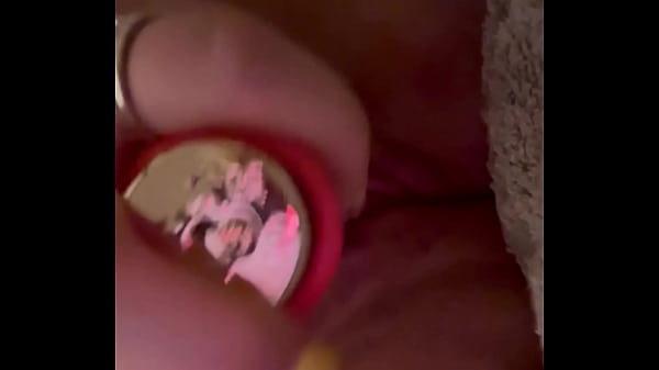 Precisa de atenção