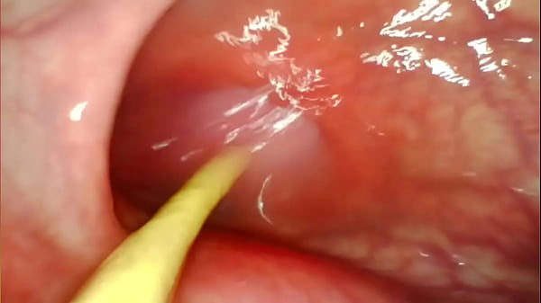 EXTREME ANAL POV. CAMERA INSIDE HER ASSHOLE AS I POUND HER WITH MY BIG COCK AND CUM DEEP INSIDE