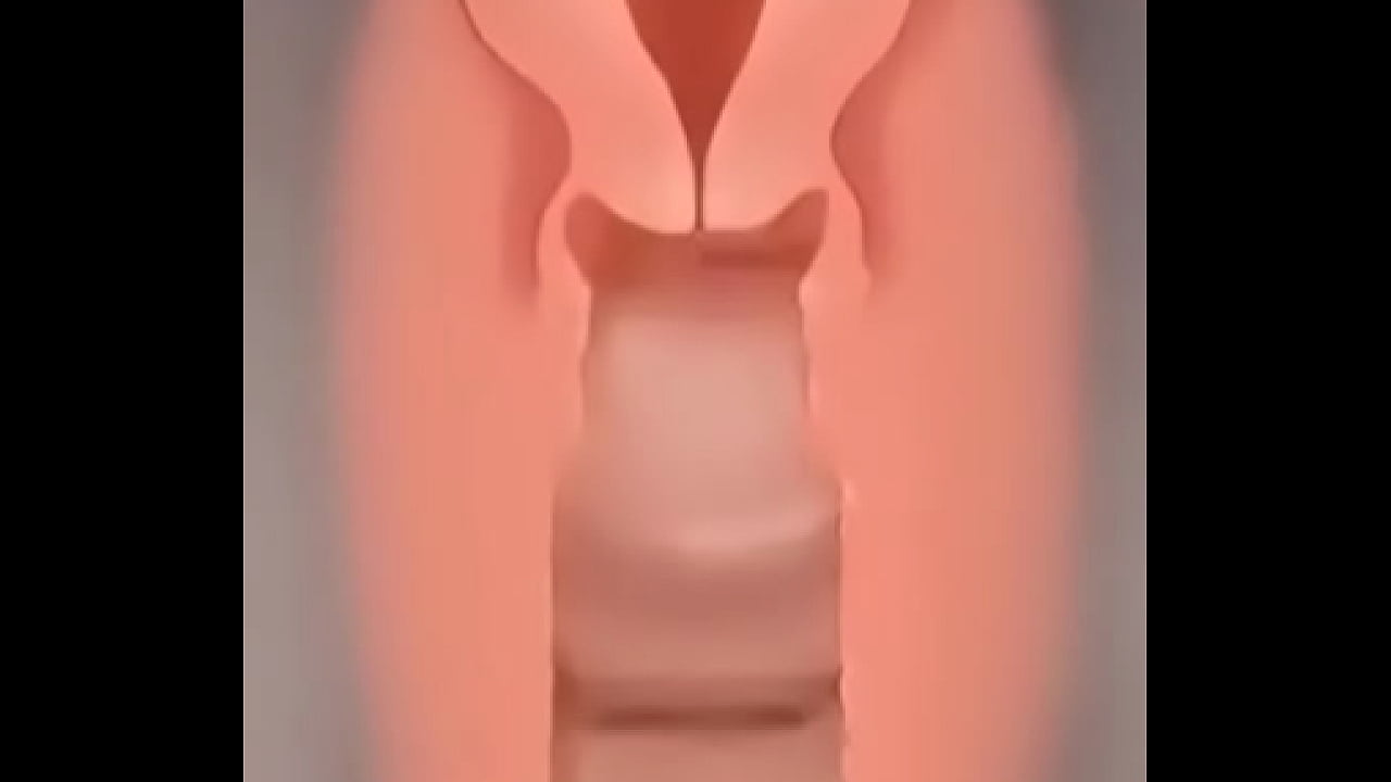 Kateterni qanday kiritish kerak (video)