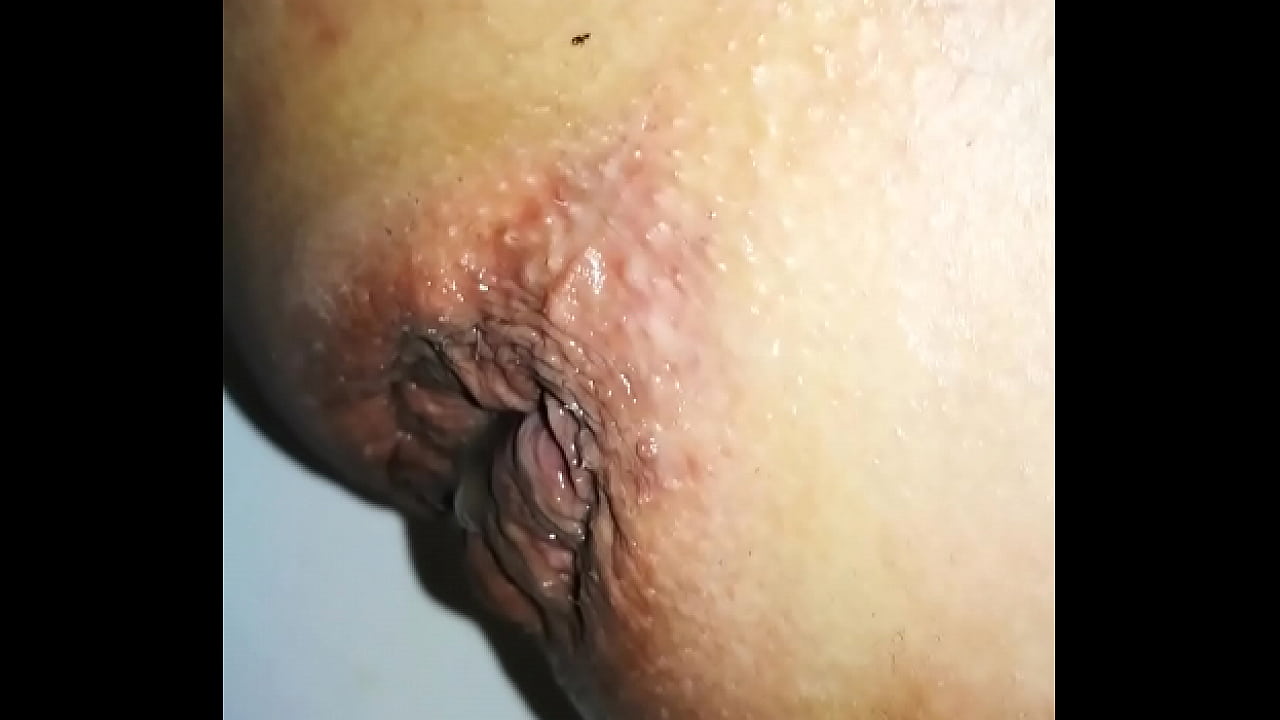 Gay Anal Cum In Ass Gay Anal Cum In Ass