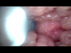  - Endoscope camera shows the most sensitive parts of the penis Educational video