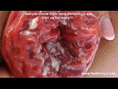  - Sexy self anal fisting on the beach & prolapse