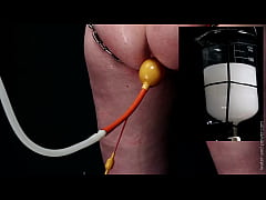  - Sparkle Struggle Part 3