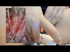  - Extreme vore compilation - Extreme vaginal endoscopy orgasm