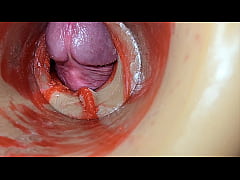  - Female Insemination - Internal Camera Captures Deep Male Huge Ejaculation