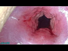  - Uncensored Japanese Cervix Stretching and Uterus Dilation with Penetration