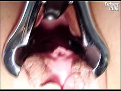  - Rachael pussy gyno speculum fetish examined