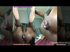  - Huge toys & Glove Play made me fart till I prolapse now my ass tongue hangs out like one of the boys (Hardworking Twink and his freeloading asshole ) Ass Monkey TheAmOfficial