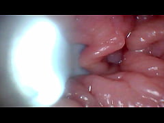  - First time: An endoscope reveals the G-spot up close – without mounting!