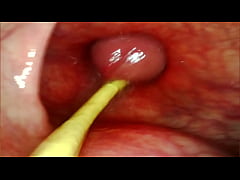  - ANAL POV. CAMERA INSIDE HER ASSHOLE AS I POUND HER WITH MY BIG COCK AND CUM DEEP INSIDE