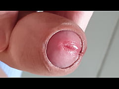  - 包皮翻開的瞬間