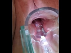  - Pulsante multiorgasmo dentro de la vagina