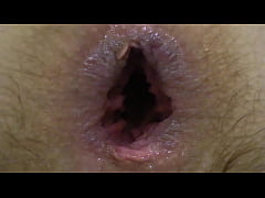 - Asshole gaping and anal masturbation with wide dildo and hairy pussy fingering Homemade fetish with anal and clitoral orgasm Homemade fetish