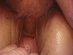  - Fuck and creampie in urethra