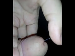  - How my dick looks like after circumcision