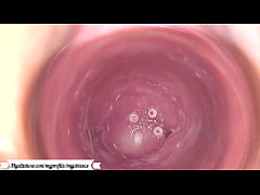  - Camera in the vagina